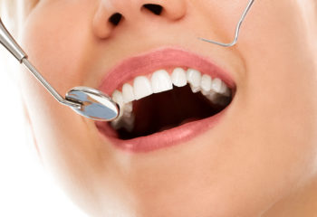 Maintaining Healthy Teeth: Tips for Optimal Oral Health